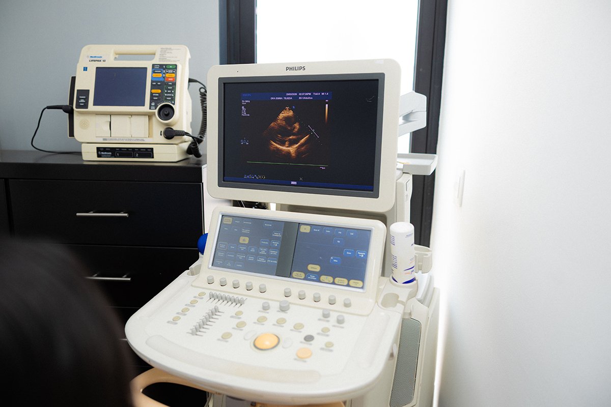 Ecocardiograma de Estrés