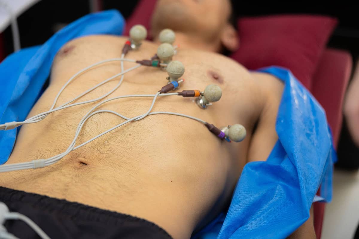 Electro Cardiograma