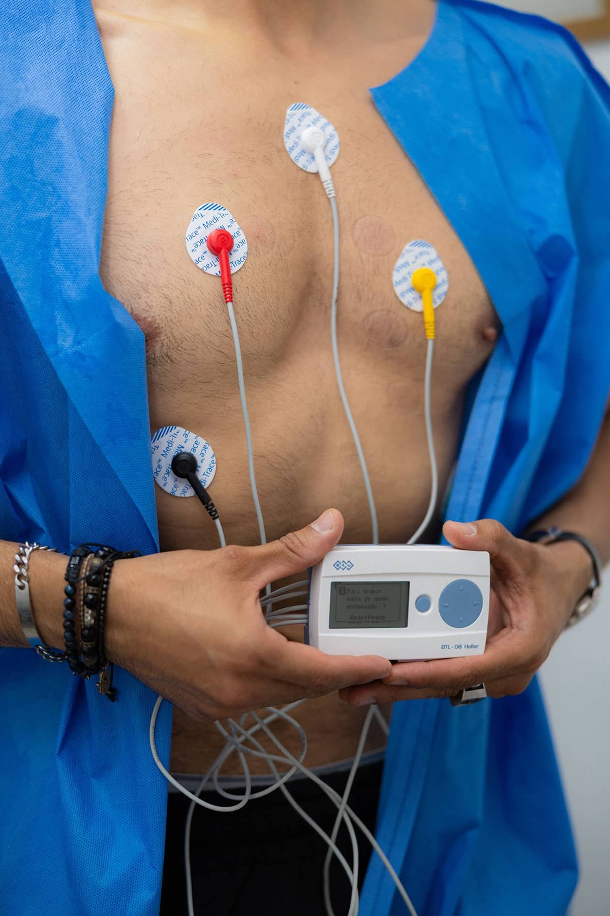 Holter de 24 Horas