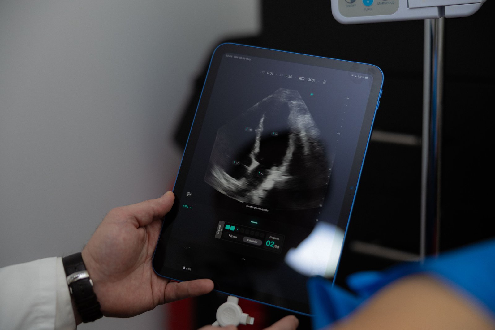Insuficiencia Cardiaca